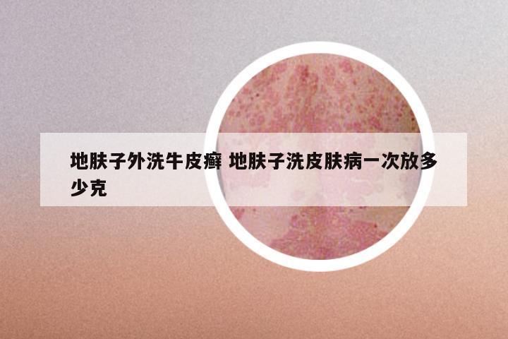 地肤子外洗牛皮癣 地肤子洗皮肤病一次放多少克