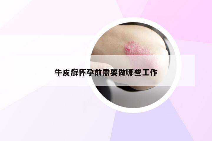 牛皮癣怀孕前需要做哪些工作