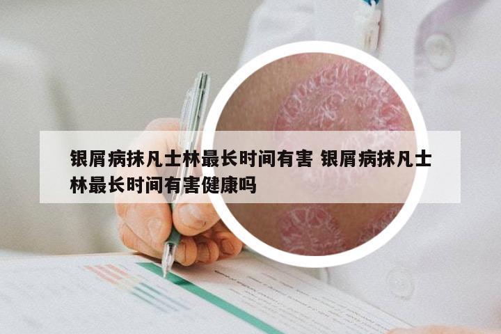 银屑病抹凡士林最长时间有害 银屑病抹凡士林最长时间有害健康吗