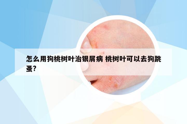怎么用狗桃树叶治银屑病 桃树叶可以去狗跳蚤?