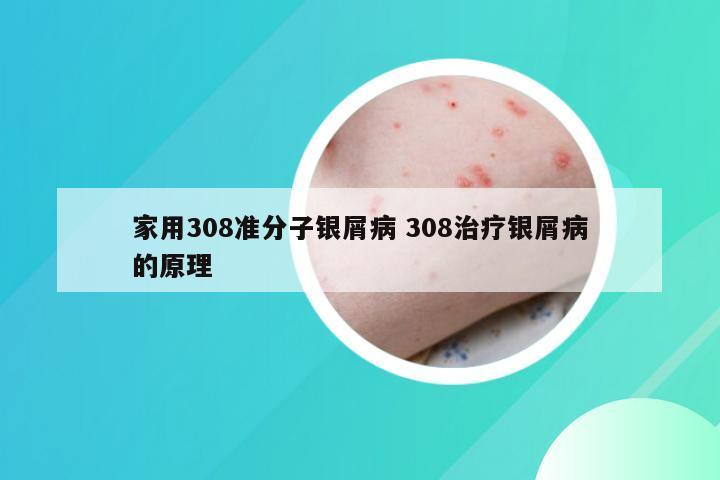 家用308准分子银屑病 308治疗银屑病的原理