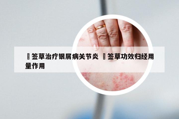 豨签草治疗银屑病关节炎 豨签草功效归经用量作用
