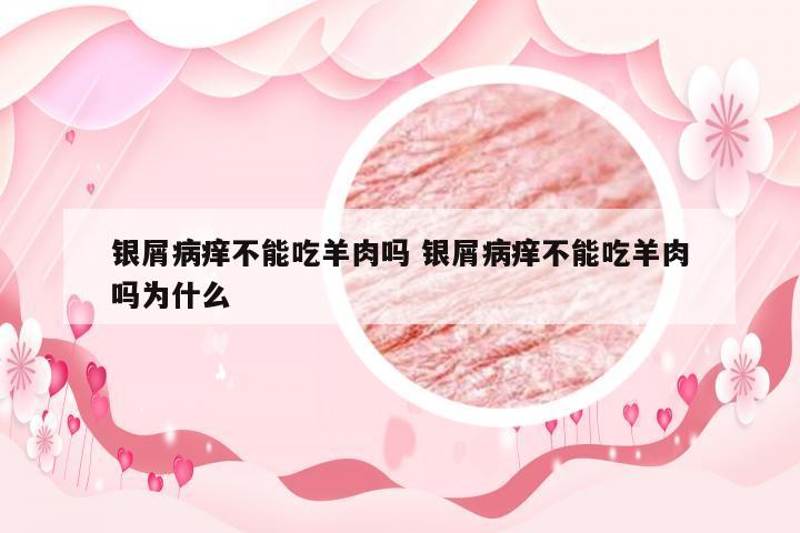 银屑病痒不能吃羊肉吗 银屑病痒不能吃羊肉吗为什么