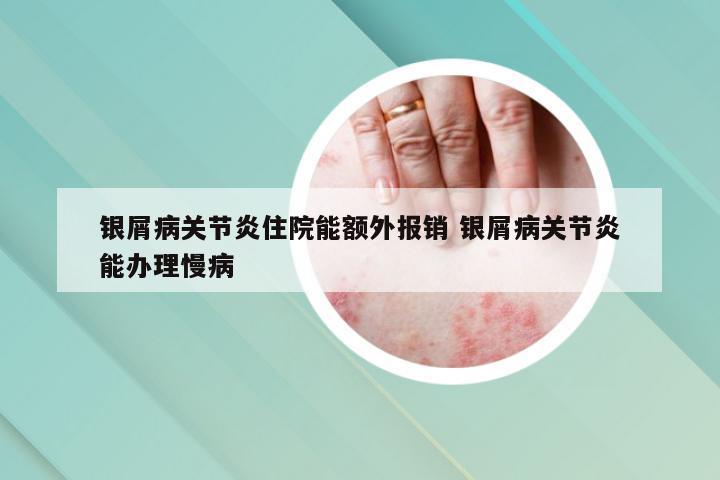 银屑病关节炎住院能额外报销 银屑病关节炎能办理慢病