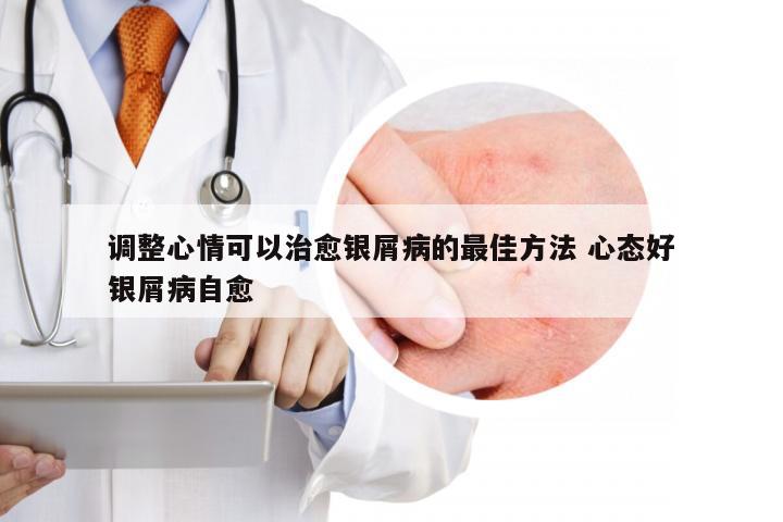 调整心情可以治愈银屑病的最佳方法 心态好银屑病自愈