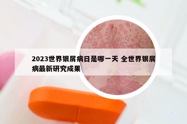 2023世界银屑病日是哪一天 全世界银屑病最新研究成果