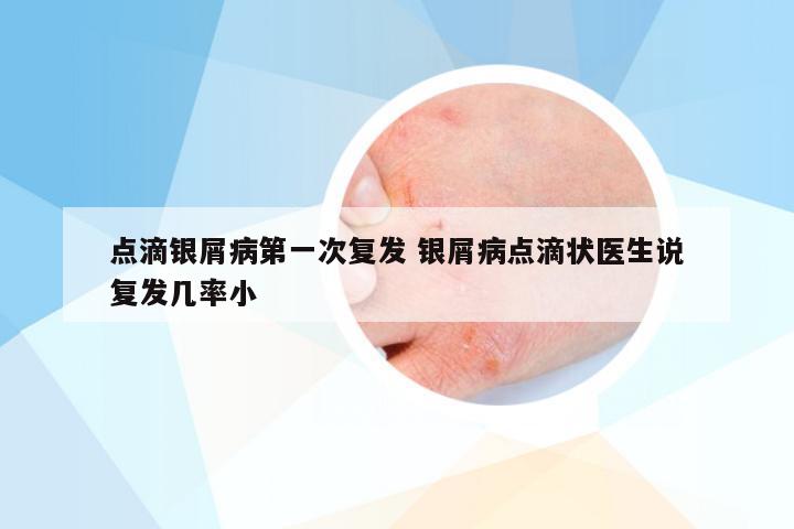 点滴银屑病第一次复发 银屑病点滴状医生说复发几率小