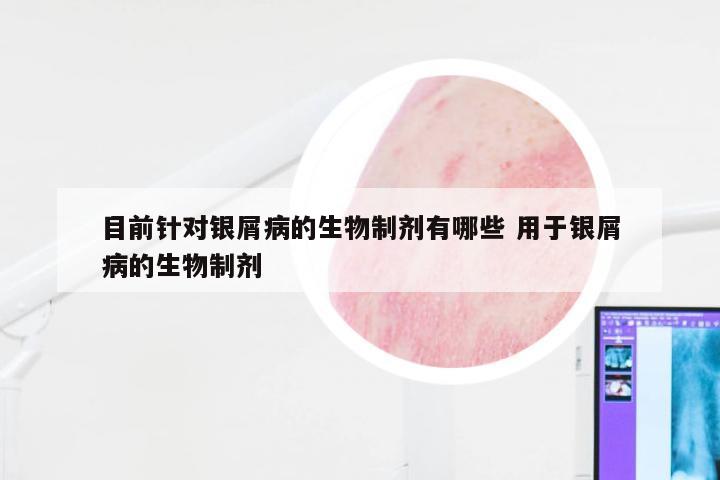 目前针对银屑病的生物制剂有哪些 用于银屑病的生物制剂