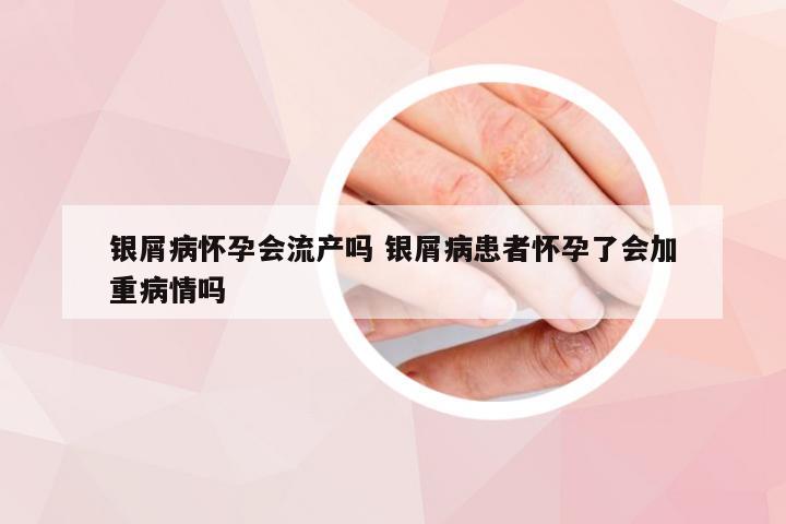 银屑病怀孕会流产吗 银屑病患者怀孕了会加重病情吗