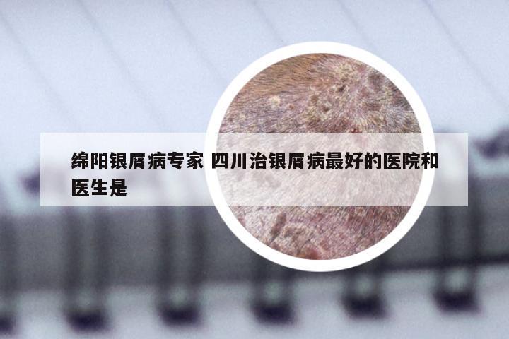 绵阳银屑病专家 四川治银屑病最好的医院和医生是