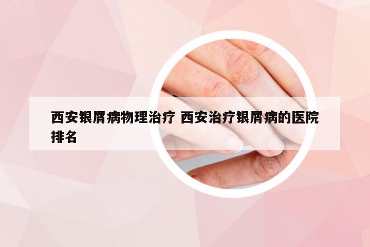 西安银屑病物理治疗 西安治疗银屑病的医院排名