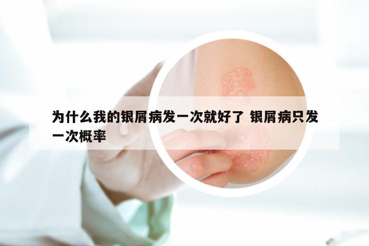 为什么我的银屑病发一次就好了 银屑病只发一次概率