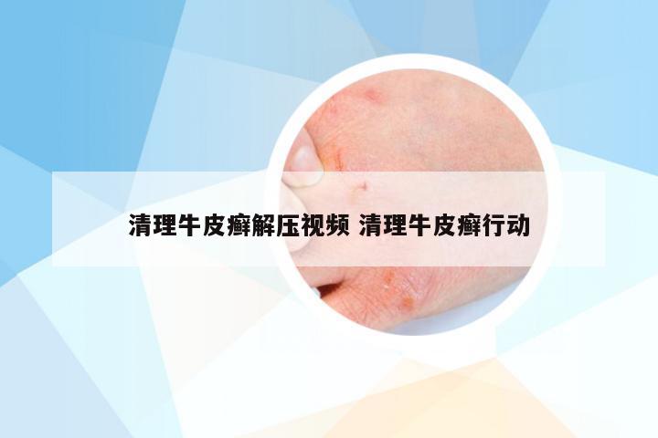 清理牛皮癣解压视频 清理牛皮癣行动