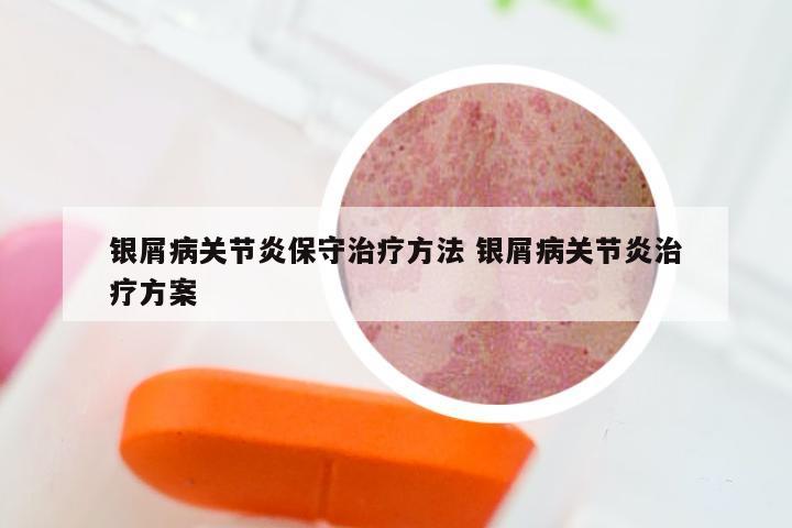 银屑病关节炎保守治疗方法 银屑病关节炎治疗方案