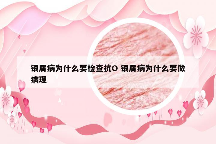银屑病为什么要检查抗O 银屑病为什么要做病理