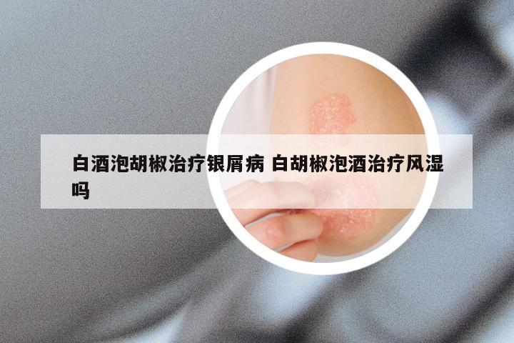 白酒泡胡椒治疗银屑病 白胡椒泡酒治疗风湿吗