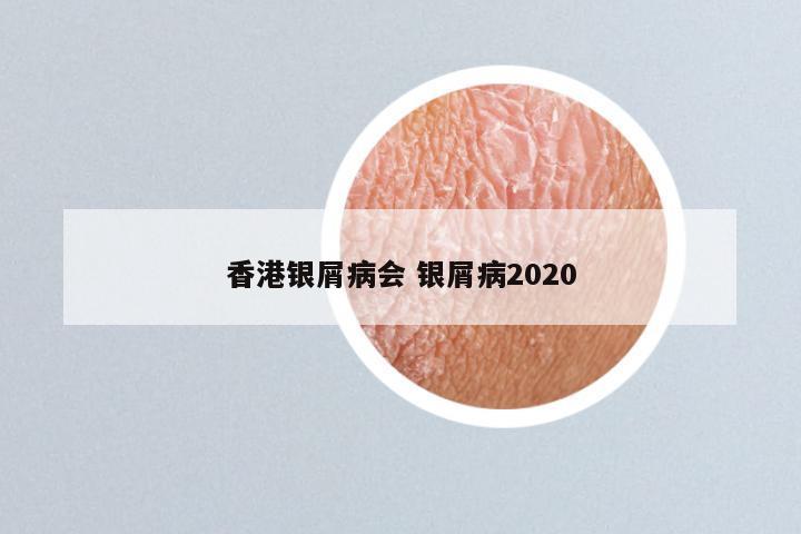 香港银屑病会 银屑病2020