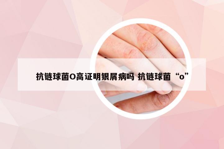 抗链球菌O高证明银屑病吗 抗链球菌“o”