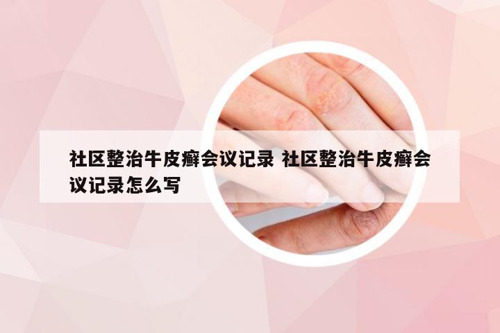 社区整治牛皮癣会议记录 社区整治牛皮癣会议记录怎么写
