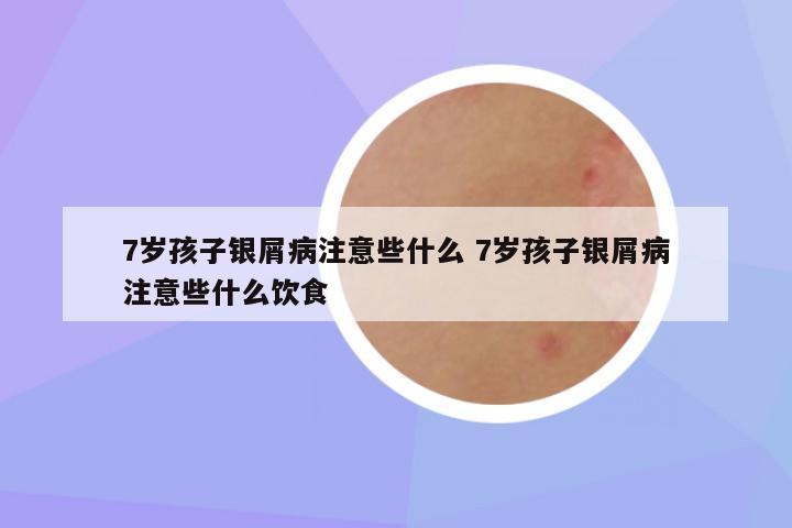 7岁孩子银屑病注意些什么 7岁孩子银屑病注意些什么饮食