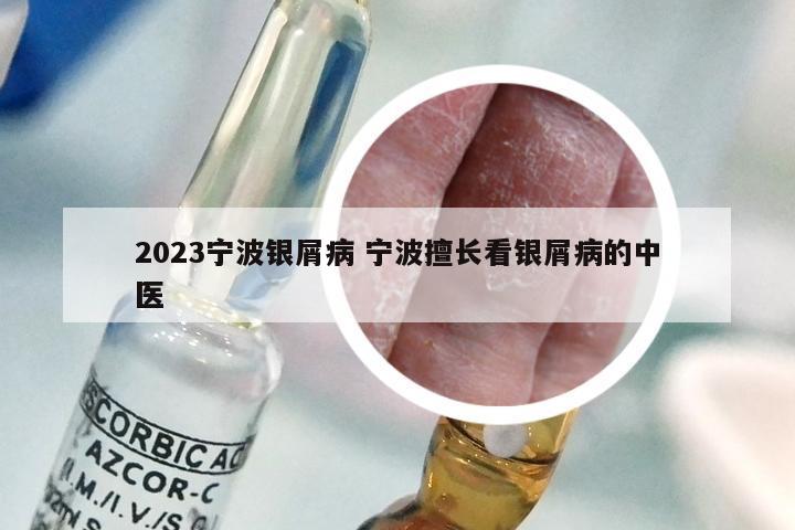 2023宁波银屑病 宁波擅长看银屑病的中医