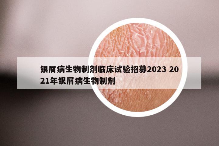 银屑病生物制剂临床试验招募2023 2021年银屑病生物制剂
