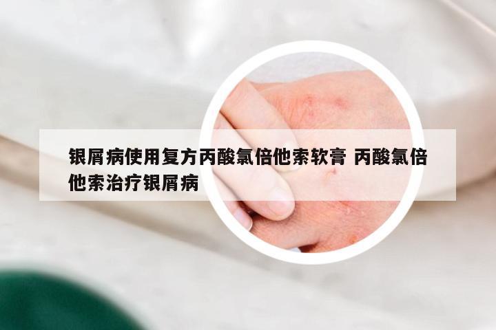 银屑病使用复方丙酸氯倍他索软膏 丙酸氯倍他索治疗银屑病