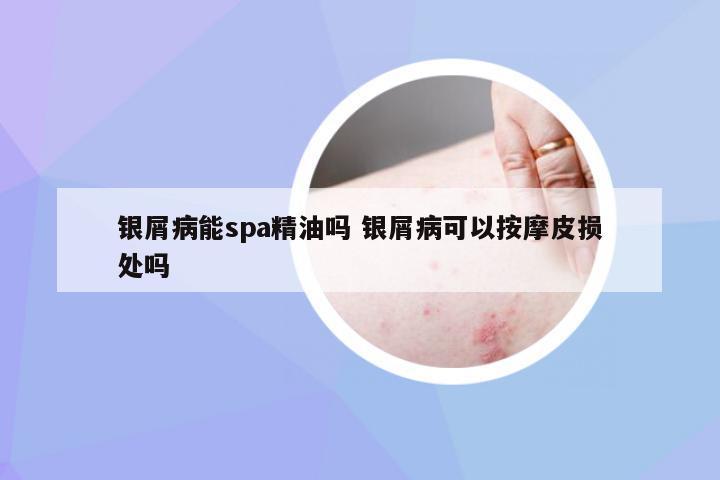 银屑病能spa精油吗 银屑病可以按摩皮损处吗