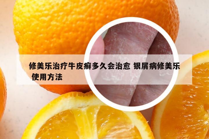 修美乐治疗牛皮癣多久会治愈 银屑病修美乐 使用方法