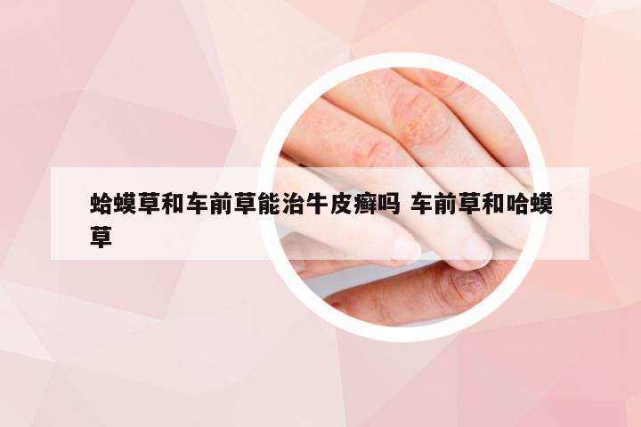 蛤蟆草和车前草能治牛皮癣吗 车前草和哈蟆草