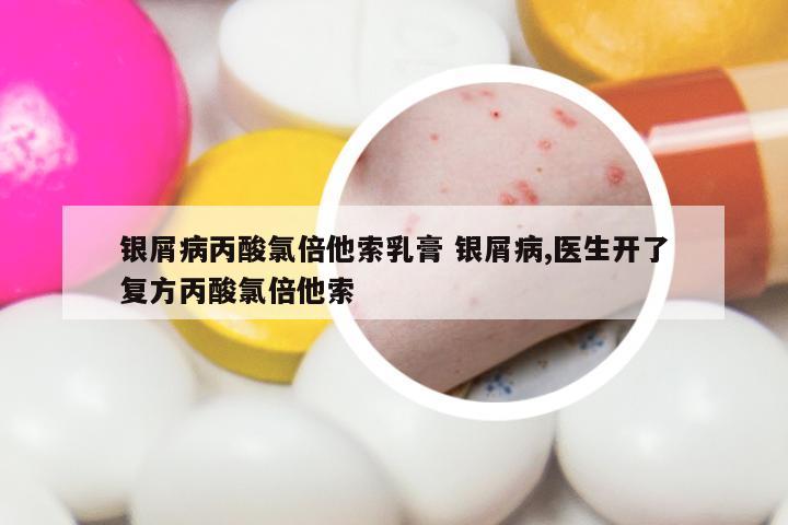 银屑病丙酸氯倍他索乳膏 银屑病,医生开了复方丙酸氯倍他索