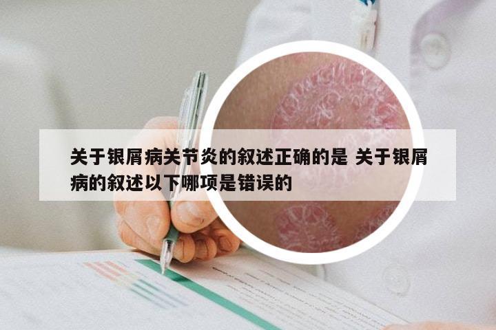 关于银屑病关节炎的叙述正确的是 关于银屑病的叙述以下哪项是错误的