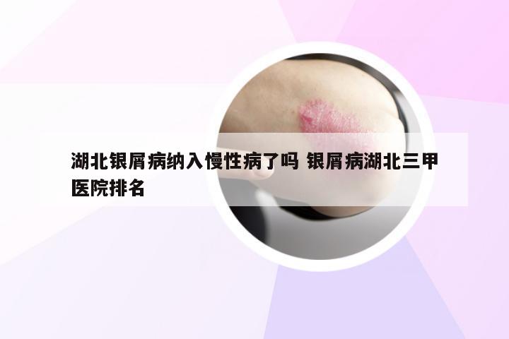 湖北银屑病纳入慢性病了吗 银屑病湖北三甲医院排名