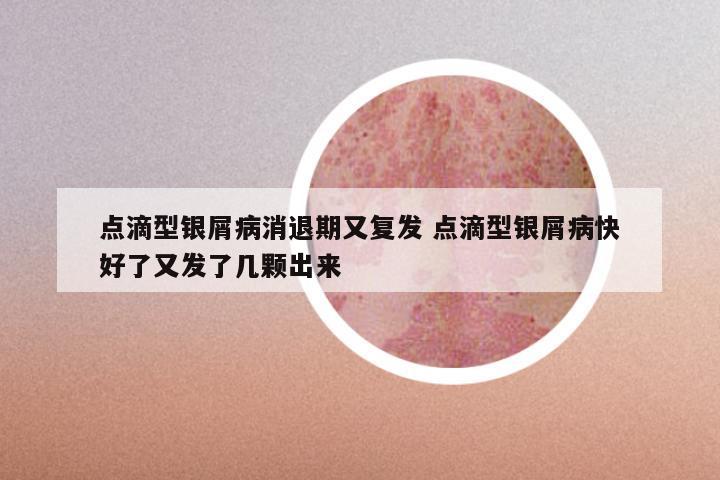 点滴型银屑病消退期又复发 点滴型银屑病快好了又发了几颗出来