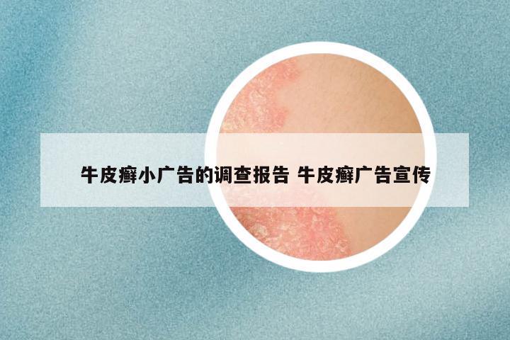 牛皮癣小广告的调查报告 牛皮癣广告宣传