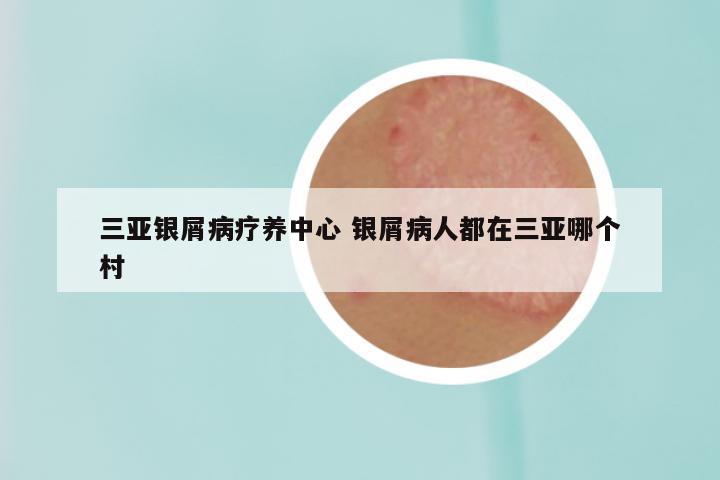 三亚银屑病疗养中心 银屑病人都在三亚哪个村