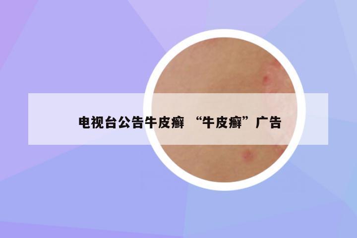 电视台公告牛皮癣 “牛皮癣”广告