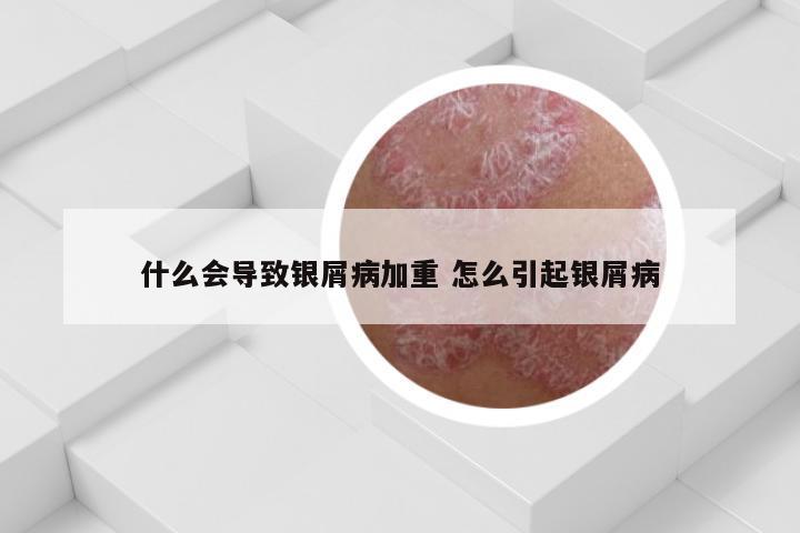 什么会导致银屑病加重 怎么引起银屑病