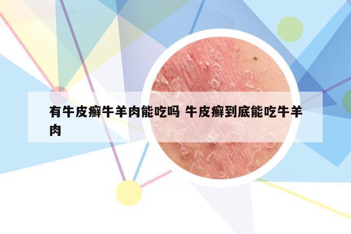 有牛皮癣牛羊肉能吃吗 牛皮癣到底能吃牛羊肉