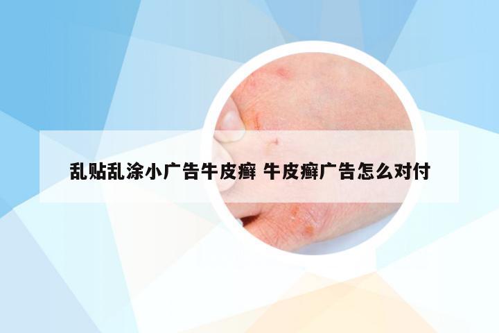 乱贴乱涂小广告牛皮癣 牛皮癣广告怎么对付