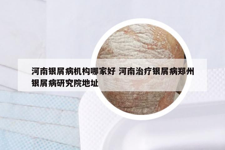 河南银屑病机构哪家好 河南治疗银屑病郑州银屑病研究院地址