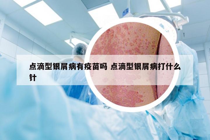 点滴型银屑病有疫苗吗 点滴型银屑病打什么针