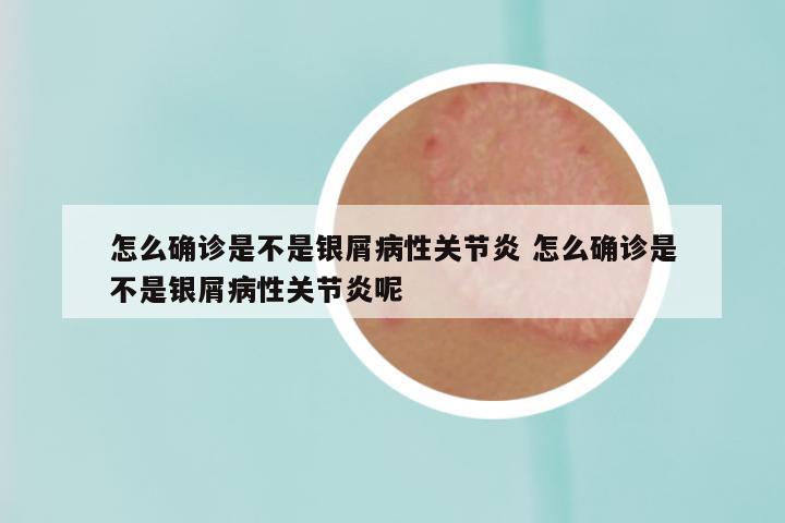 怎么确诊是不是银屑病性关节炎 怎么确诊是不是银屑病性关节炎呢