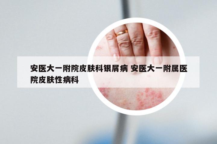 安医大一附院皮肤科银屑病 安医大一附属医院皮肤性病科