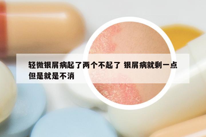 轻微银屑病起了两个不起了 银屑病就剩一点但是就是不消
