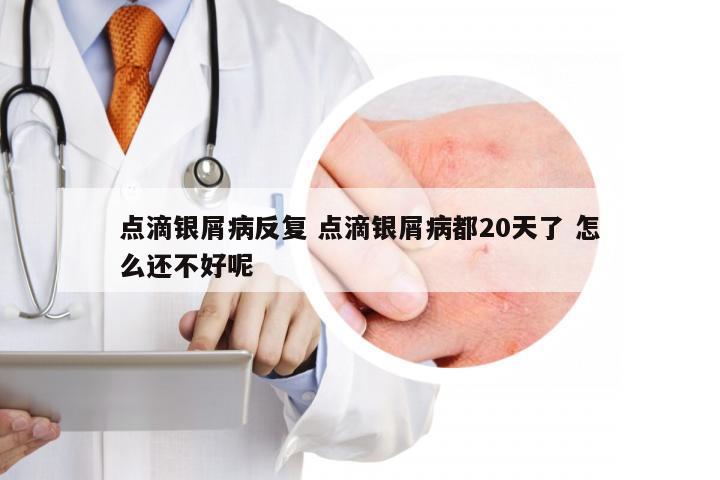 点滴银屑病反复 点滴银屑病都20天了 怎么还不好呢