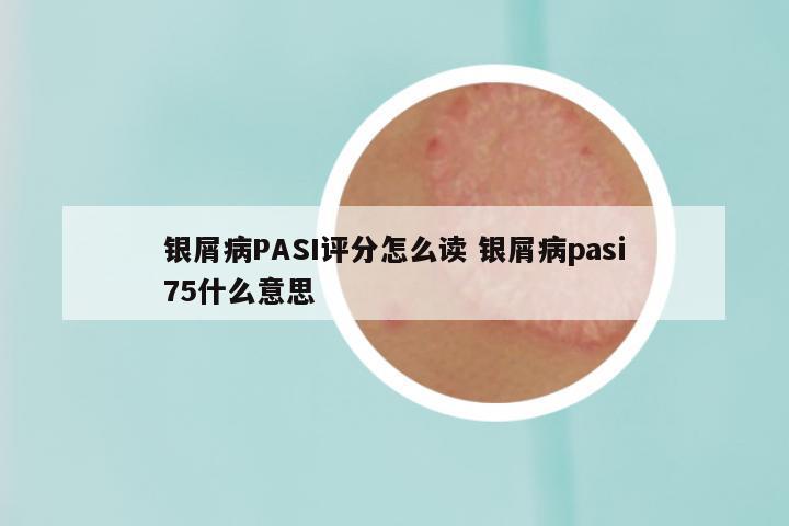银屑病PASI评分怎么读 银屑病pasi75什么意思