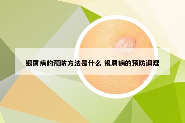 银屑病的预防方法是什么 银屑病的预防调理