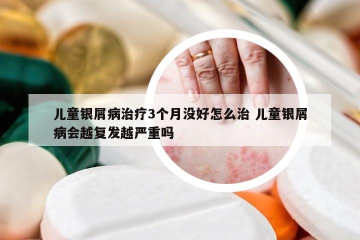 儿童银屑病治疗3个月没好怎么治 儿童银屑病会越复发越严重吗