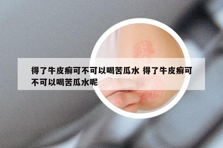 得了牛皮癣可不可以喝苦瓜水 得了牛皮癣可不可以喝苦瓜水呢